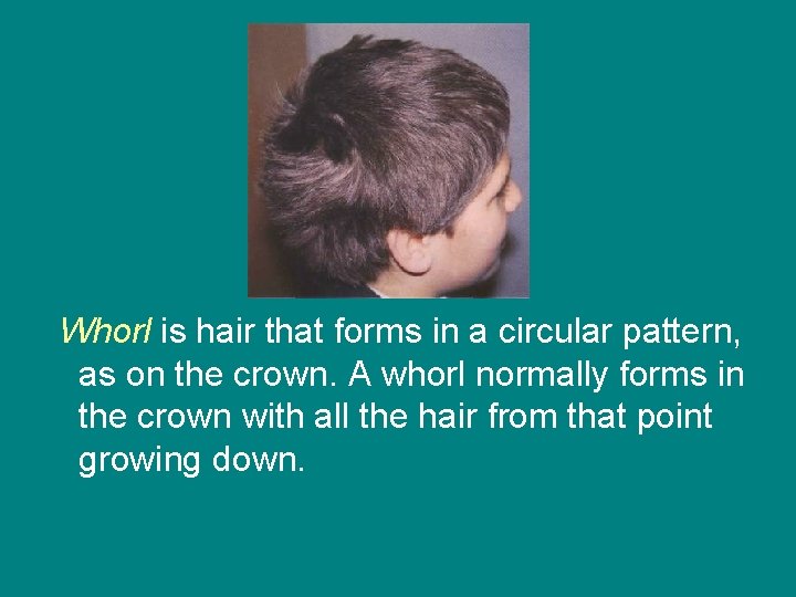 Whorl is hair that forms in a circular pattern, as on the crown. A