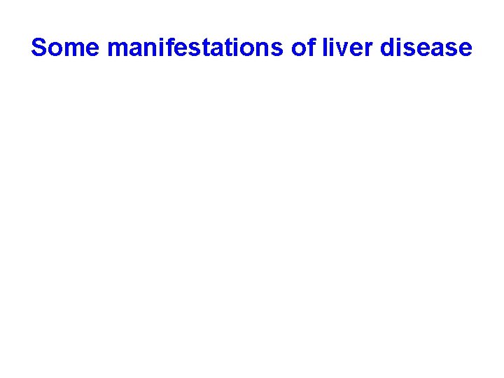 Some manifestations of liver disease 