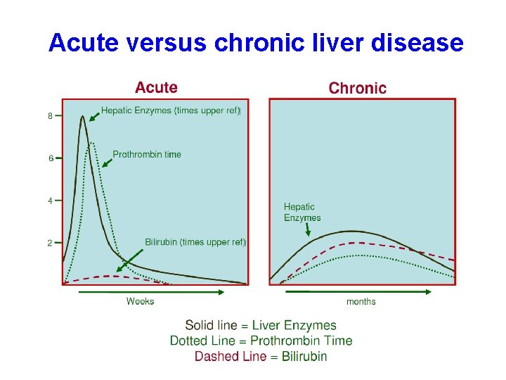 Acute versus chronic liver disease 