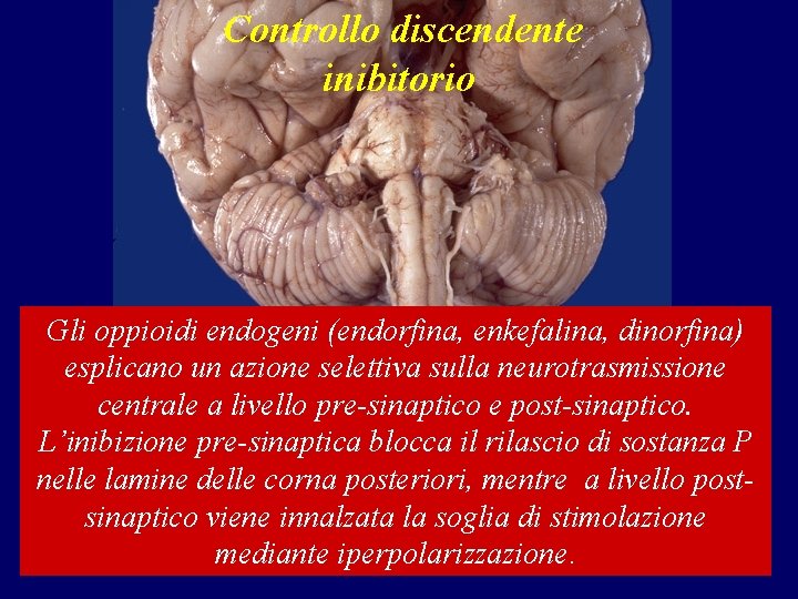Controllo discendente inibitorio Gli oppioidi endogeni (endorfina, enkefalina, dinorfina) esplicano un azione selettiva sulla Controllo discendente inibitorio Gli oppioidi endogeni (endorfina, enkefalina, dinorfina) esplicano un azione selettiva sulla