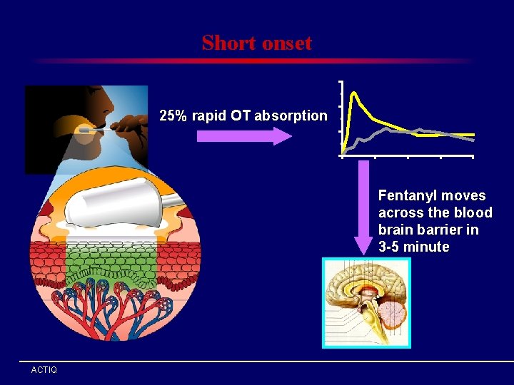 Short onset 25% rapid OT absorption Fentanyl moves across the blood brain barrier in Short onset 25% rapid OT absorption Fentanyl moves across the blood brain barrier in