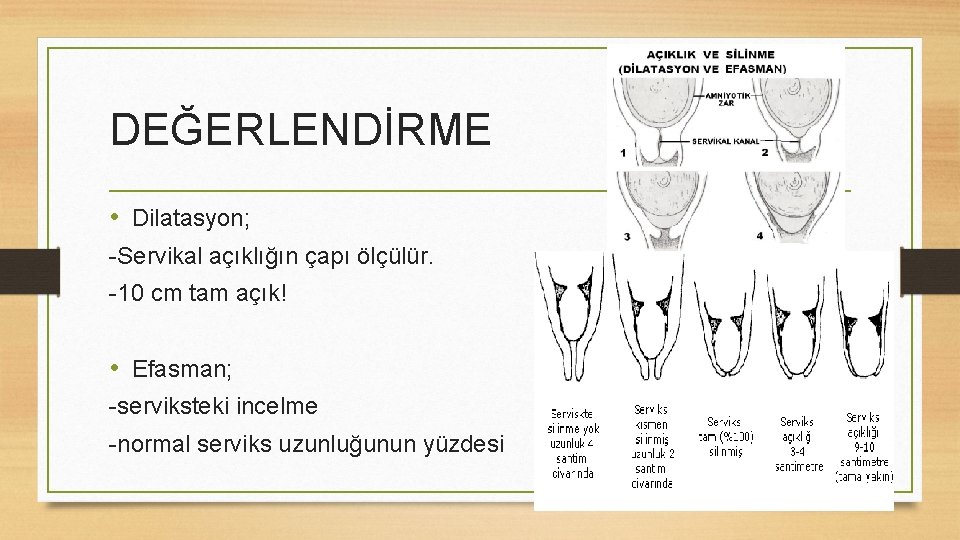 DEĞERLENDİRME • Dilatasyon; -Servikal açıklığın çapı ölçülür. -10 cm tam açık! • Efasman; -serviksteki