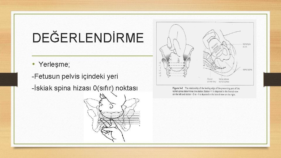 DEĞERLENDİRME • Yerleşme; -Fetusun pelvis içindeki yeri -İskiak spina hizası 0(sıfır) noktası 