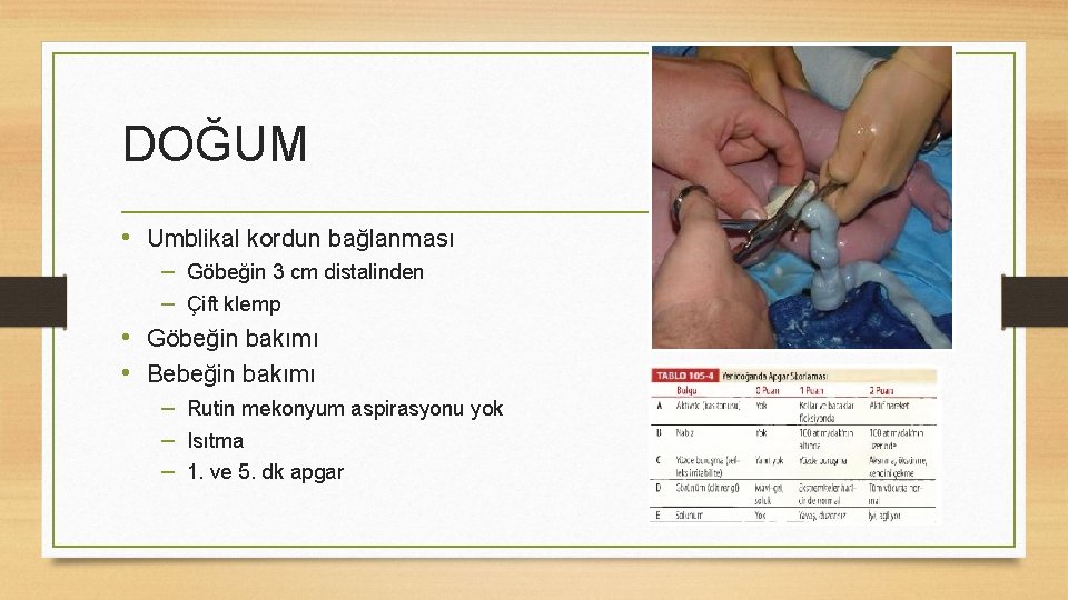 DOĞUM • Umblikal kordun bağlanması – Göbeğin 3 cm distalinden – Çift klemp •