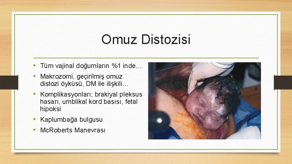 Omuz Distozisi • Tüm vajinal doğumların %1 inde… • Makrozomi, geçirilmiş omuz distozi öyküsü,