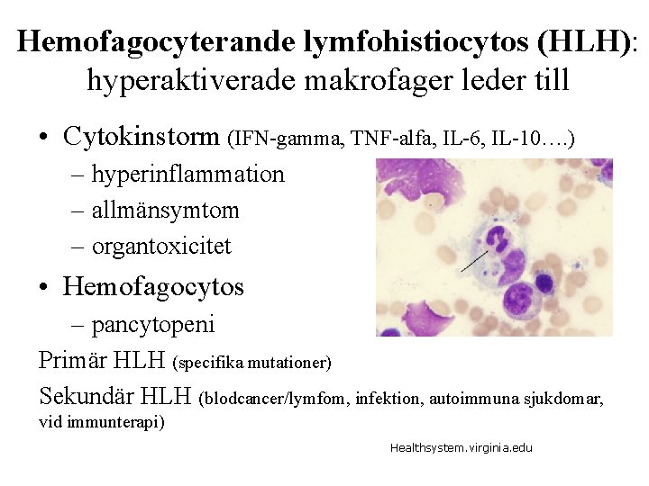 Hemofagocyterande lymfohistiocytos (HLH): hyperaktiverade makrofager leder till • Cytokinstorm (IFN-gamma, TNF-alfa, IL-6, IL-10…. )