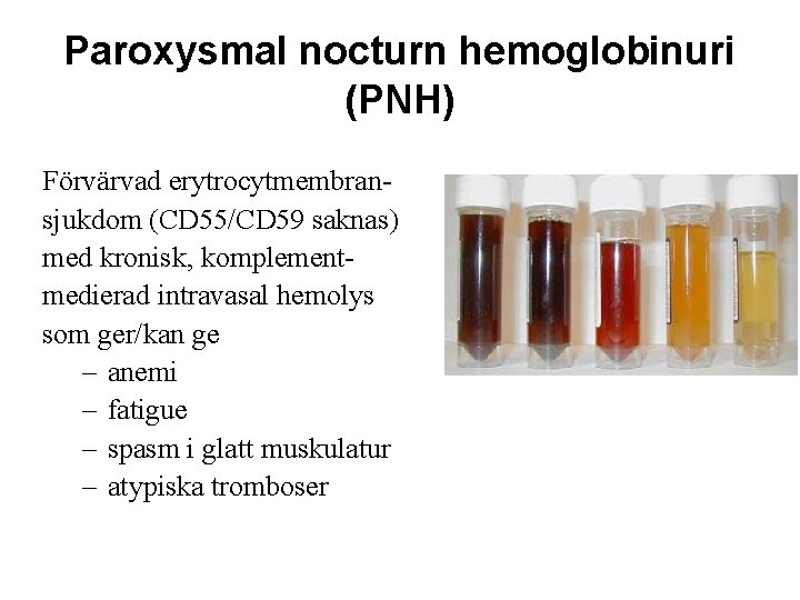 Paroxysmal nocturn hemoglobinuri (PNH) Förvärvad erytrocytmembransjukdom (CD 55/CD 59 saknas) med kronisk, komplementmedierad intravasal