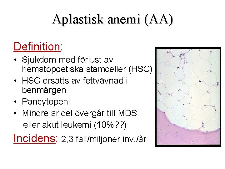 Aplastisk anemi (AA) Definition: • Sjukdom med förlust av hematopoetiska stamceller (HSC) • HSC