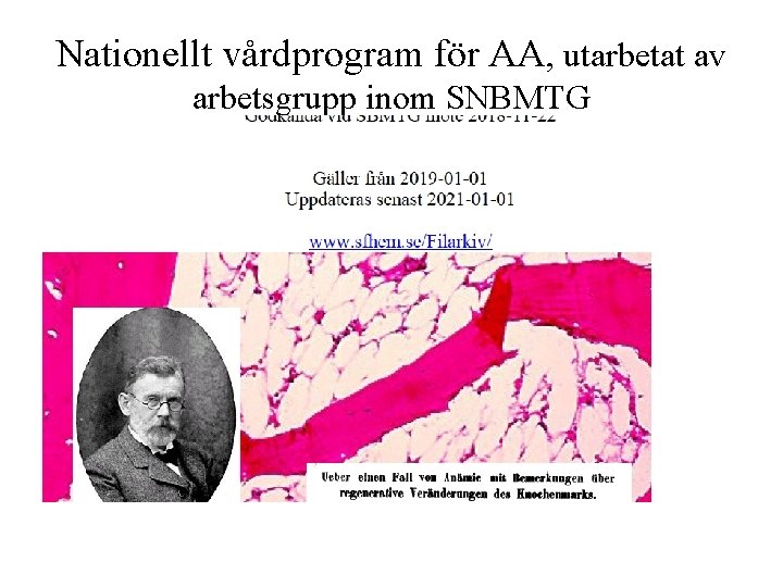 Nationellt vårdprogram för AA, utarbetat av arbetsgrupp inom SNBMTG 