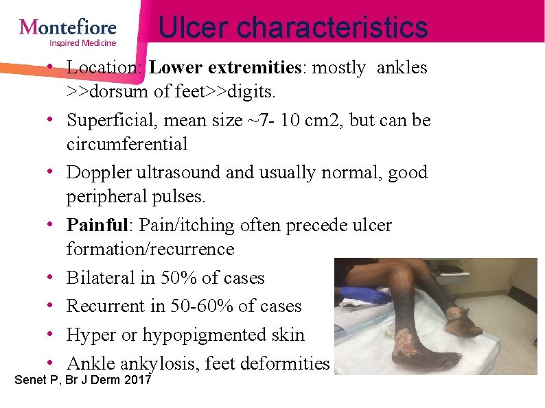 Ulcer characteristics • Location: Lower extremities: mostly ankles >>dorsum of feet>>digits. • Superficial, mean