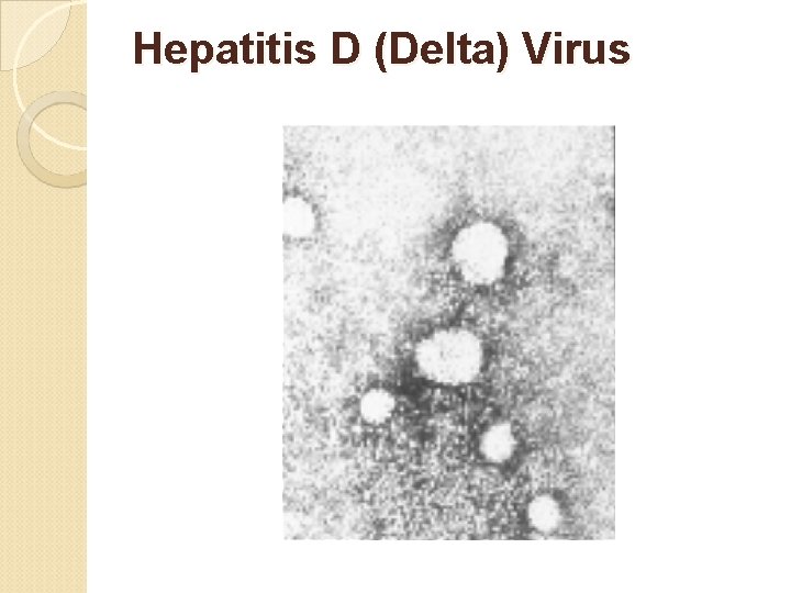 Hepatitis D (Delta) Virus Hepatitis D (Delta) Virus
