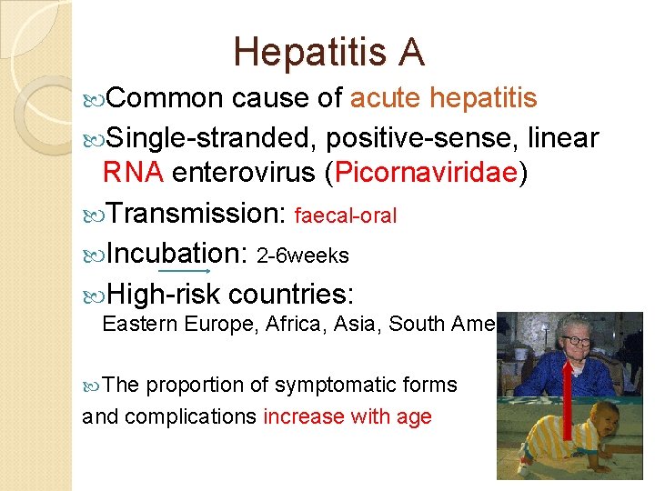 Hepatitis A Common cause of acute hepatitis Single-stranded, positive-sense, linear RNA enterovirus (Picornaviridae) Hepatitis A Common cause of acute hepatitis Single-stranded, positive-sense, linear RNA enterovirus (Picornaviridae)