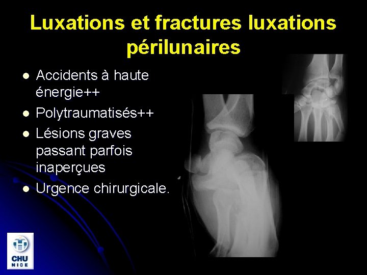 Luxations et fractures luxations périlunaires l l Accidents à haute énergie++ Polytraumatisés++ Lésions graves