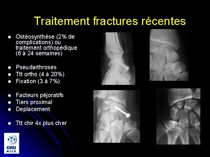 Traitement fractures récentes l Ostéosynthèse (2% de complications) ou traitement orthopédique (6 à 24