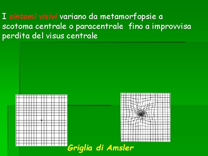 I sintomi visivi variano da metamorfopsie a scotoma centrale o paracentrale fino a improvvisa