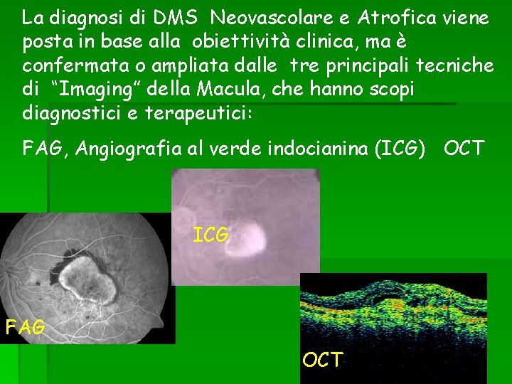 La diagnosi di DMS Neovascolare e Atrofica viene posta in base alla obiettività clinica,