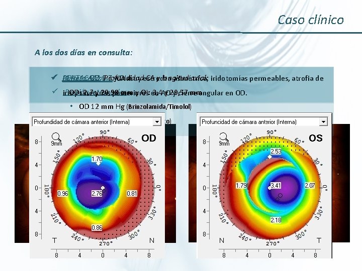 Caso clínico A los días en consulta: ü PENTACAM: AV csc: OD 0, 7