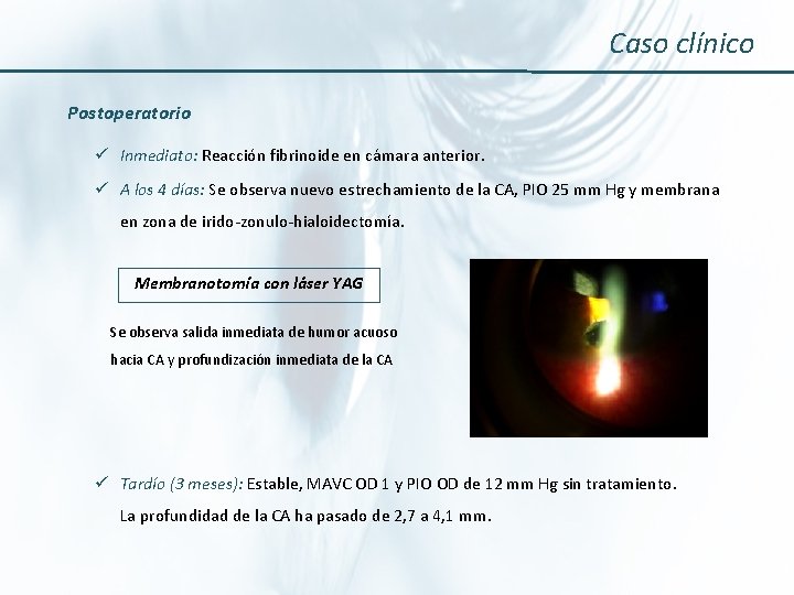 Caso clínico Postoperatorio ü Inmediato: Reacción fibrinoide en cámara anterior. ü A los 4