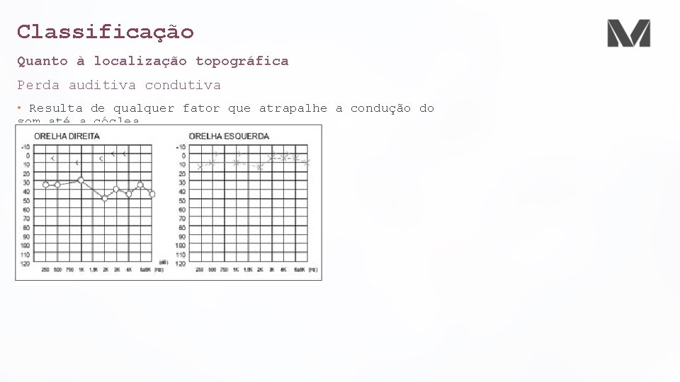 Classificação Quanto à localização topográfica Perda auditiva condutiva • Resulta de qualquer fator que