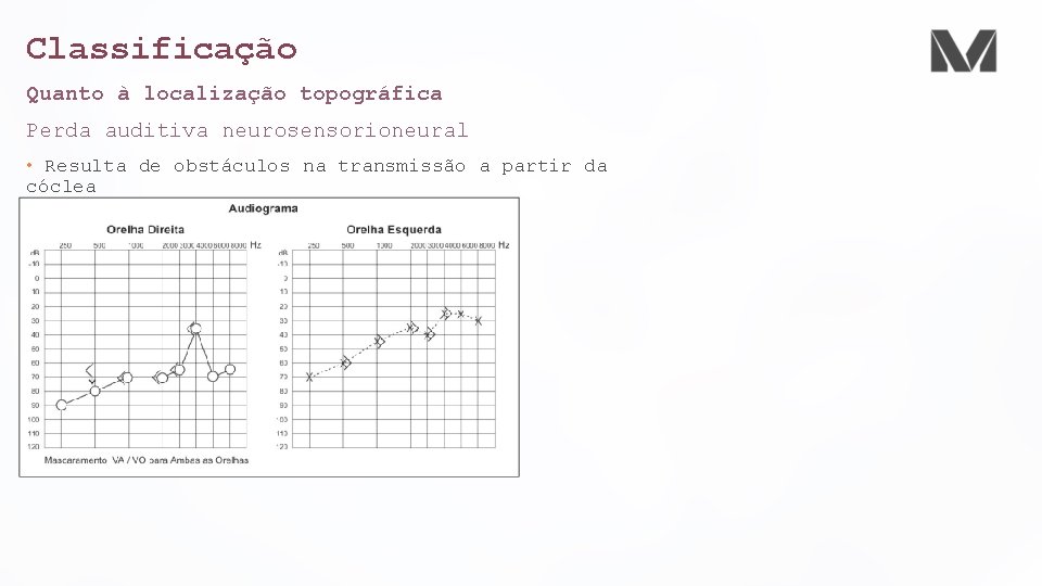 Classificação Quanto à localização topográfica Perda auditiva neurosensorioneural • Resulta de obstáculos na transmissão