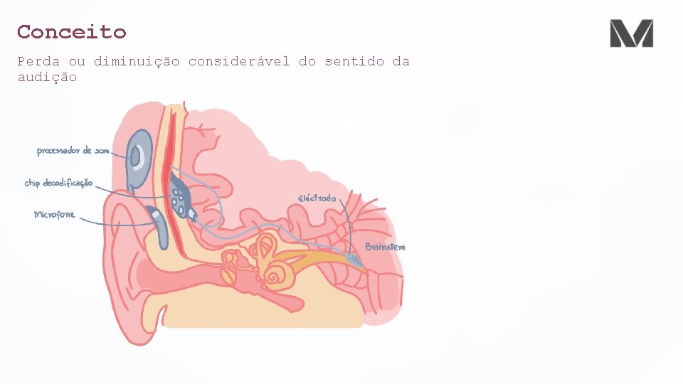 Conceito Perda ou diminuição considerável do sentido da audição 