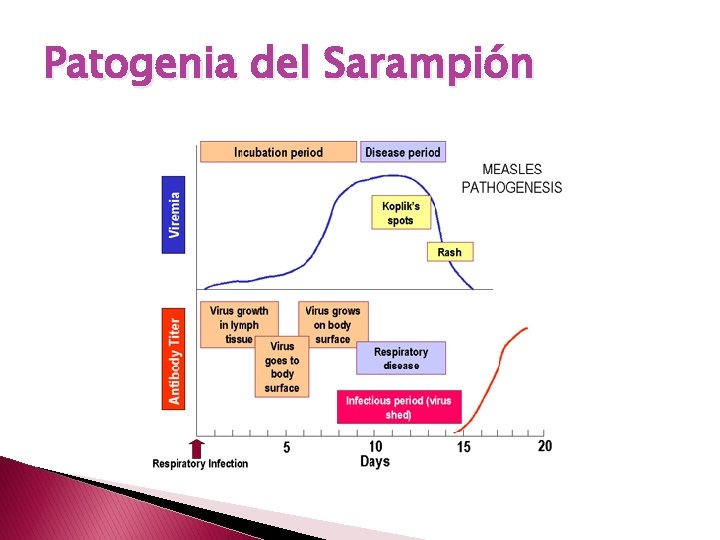 Patogenia del Sarampión 