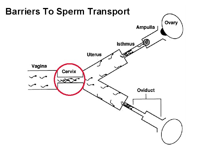 Barriers To Sperm Transport 
