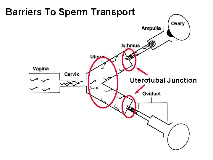 Barriers To Sperm Transport Uterotubal Junction 