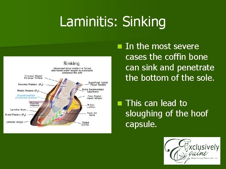 Laminitis: Sinking n In the most severe cases the coffin bone can sink and