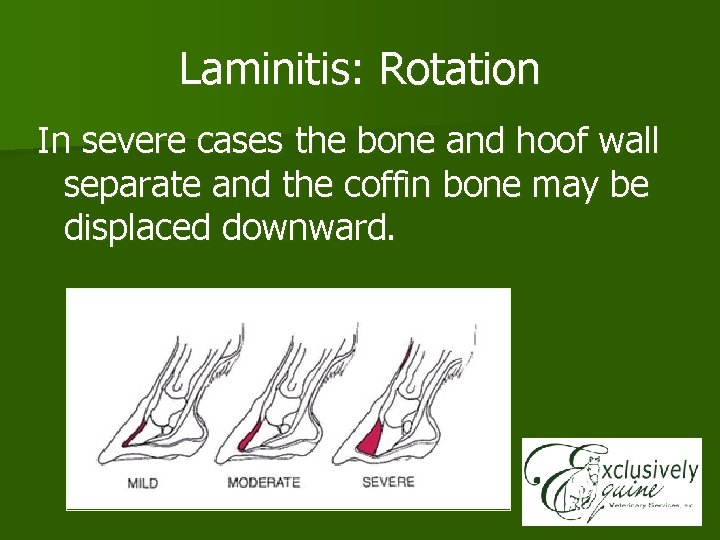Laminitis: Rotation In severe cases the bone and hoof wall separate and the coffin