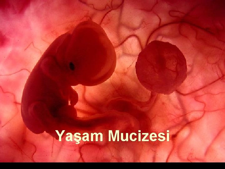 Yaşam Mucizesi Um feto de poucas semanas encontra-se no interior do útero de sua