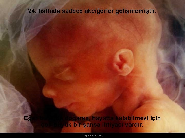 24. haftada sadece akciğerler gelişmemiştir. Eğer bu anda doğarsa, hayatta kalabilmesi için çok büyük