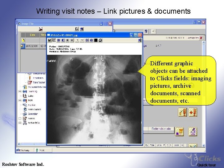 Writing visit notes – Link pictures & documents Different graphic objects can be attached