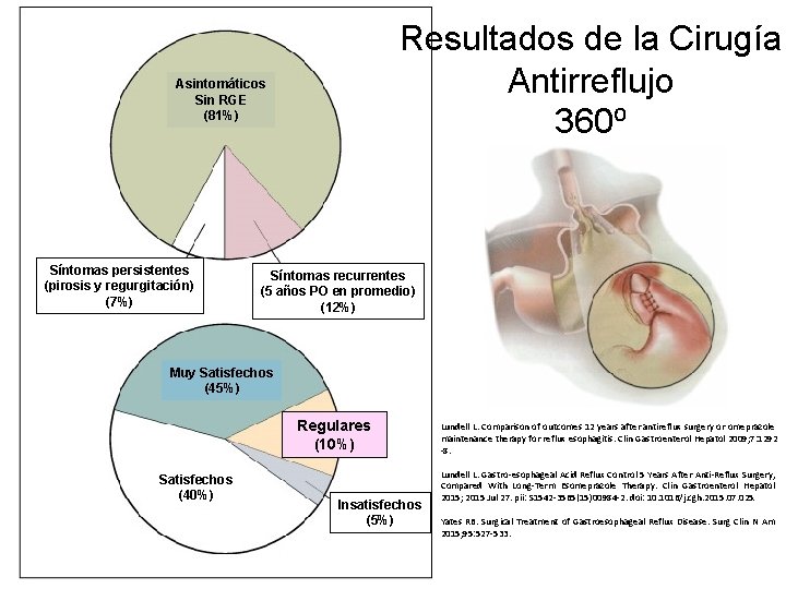 Resultados de la Cirugía Antirreflujo 360⁰ Asintomáticos Sin RGE (81%) Síntomas persistentes (pirosis y