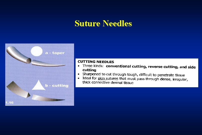 Suture Needles 