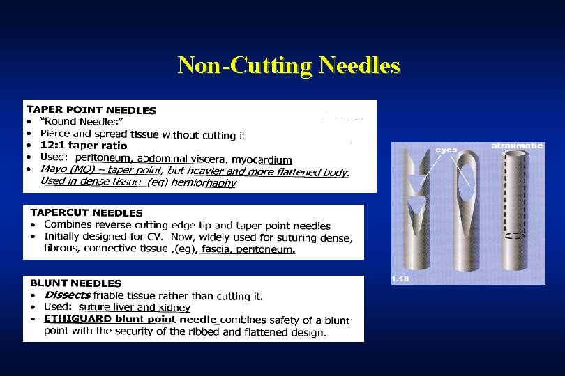 Non-Cutting Needles 