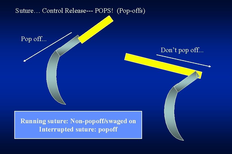 Suture… Control Release--- POPS! (Pop-offs) Pop off. . . Don’t pop off. . .