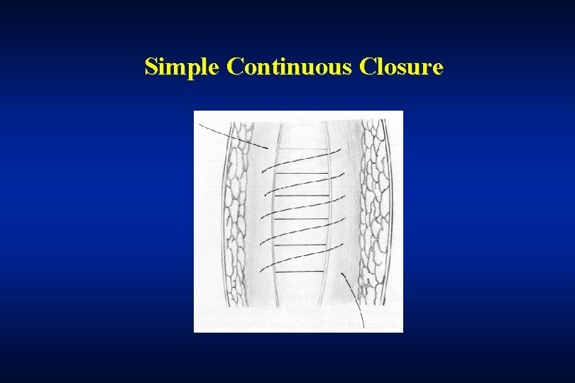 Simple Continuous Closure 
