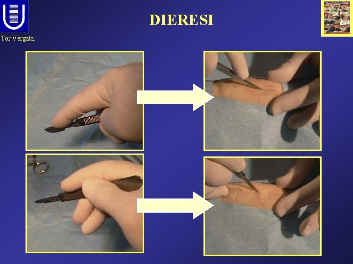 DIERESI Tor Vergata. 