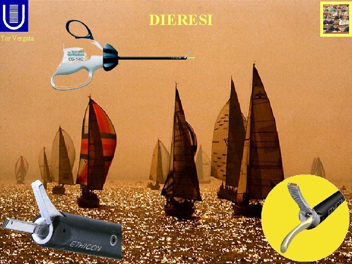 DIERESI Tor Vergata. 