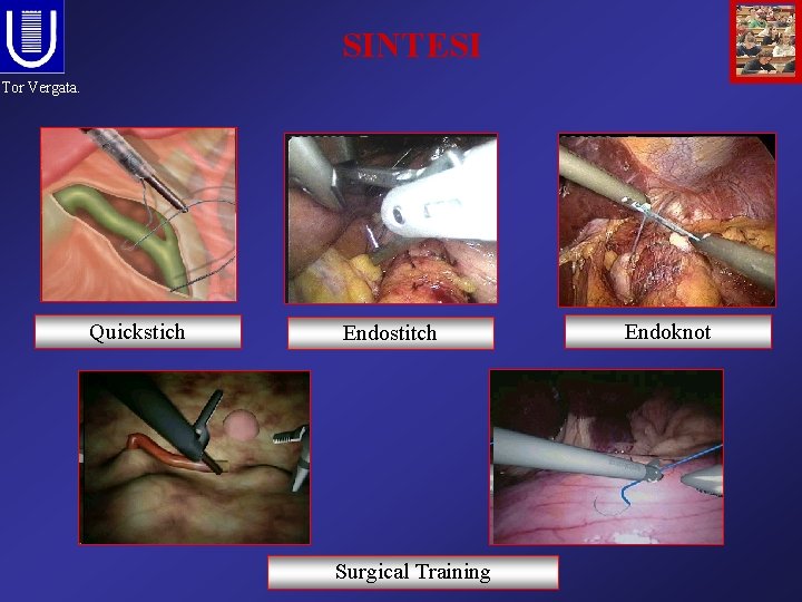 SINTESI Tor Vergata. Quickstich Endostitch Surgical Training Endoknot 