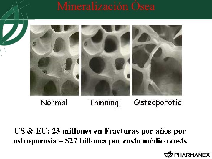 Mineralización Ósea US & EU: 23 millones en Fracturas por años por osteoporosis =