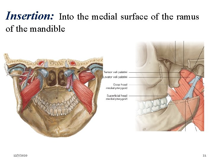 Insertion: Into the medial surface of the ramus of the mandible 12/7/2020 21 