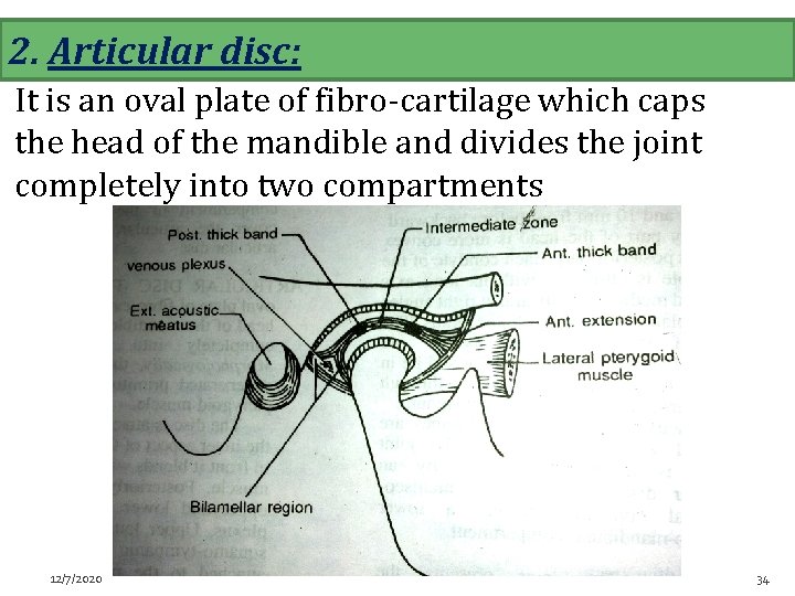 2. Articular disc: It is an oval plate of fibro-cartilage which caps the head