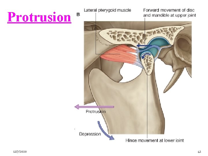 Protrusion 12/7/2020 42 