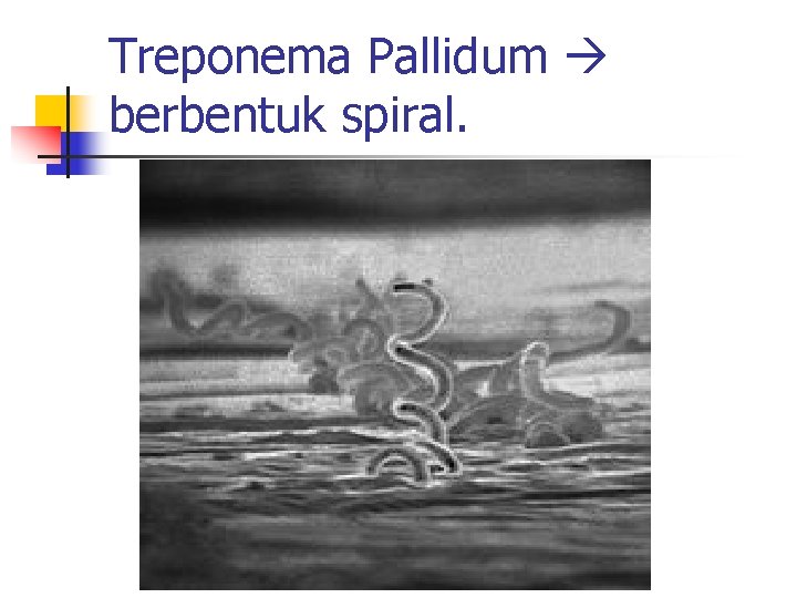 Treponema Pallidum berbentuk spiral. 