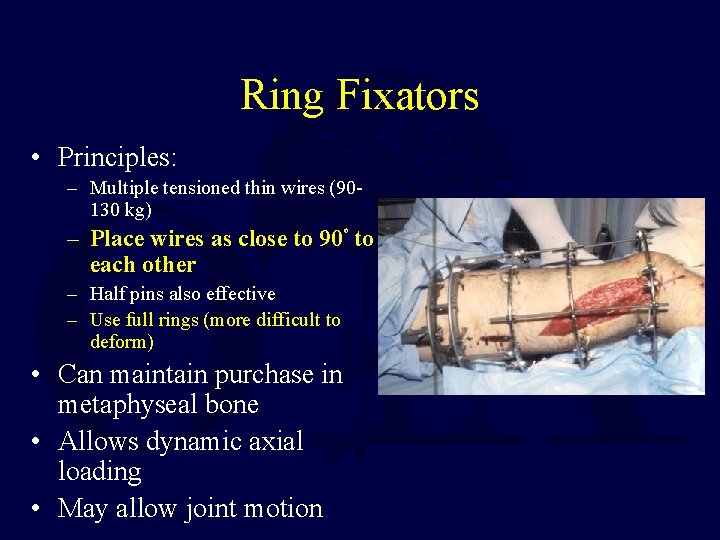 Ring Fixators • Principles: – Multiple tensioned thin wires (90130 kg) – Place wires