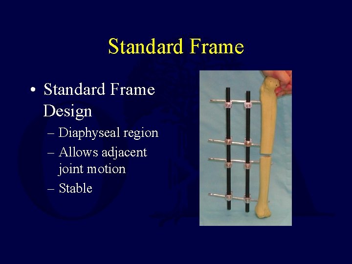 Standard Frame • Standard Frame Design – Diaphyseal region – Allows adjacent joint motion Standard Frame • Standard Frame Design – Diaphyseal region – Allows adjacent joint motion