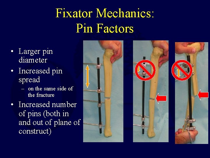Principles Of External Fixation Roman Hayda Md Original