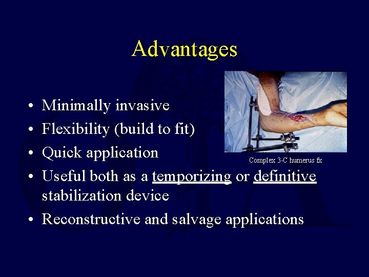 Advantages • • Minimally invasive Flexibility (build to fit) Quick application Complex 3 -C Advantages • • Minimally invasive Flexibility (build to fit) Quick application Complex 3 -C